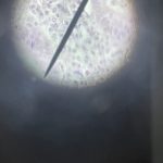 che cosa si vede sul vetrino